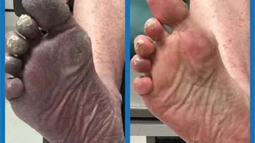 Remedy Wellness ( Regenerate Softwave , Peptide, Ketamine and Hijama Therapy) — ketamine clinic in Milpitas, California (photo 3 of 3)